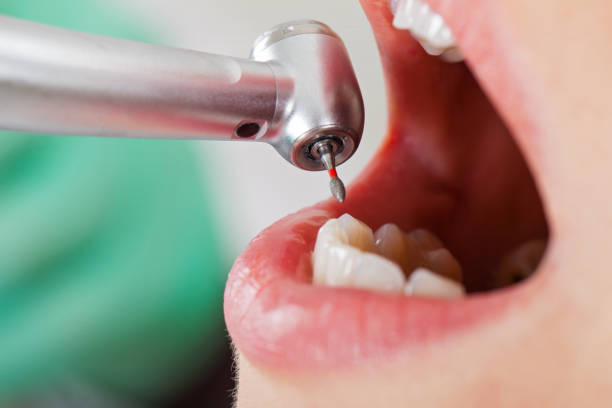 Best Emergency Dental Services for Seniors in Princess Anne, MD